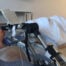 Post ACl Surgery Patient on a hospital bed with a CPM machine next to the bed