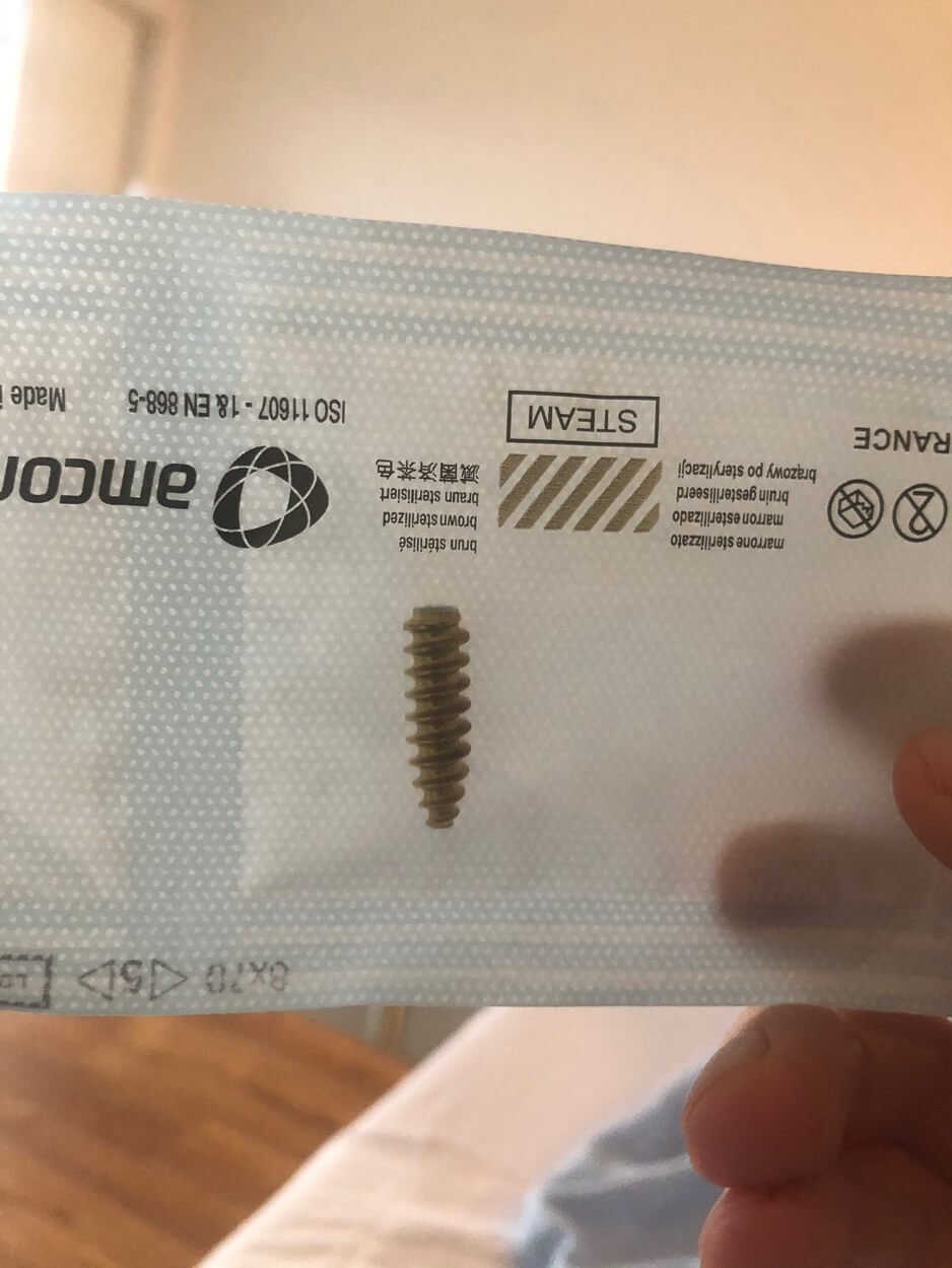 Titan screw for ACL reconstruction.